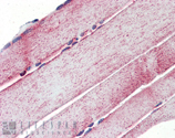 Mn SOD polyclonal antibody Immunohistochemistry