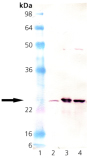 Mn SOD polyclonal antibody Western blot