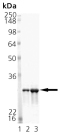 Mn SOD (mouse), (recombinant) (His-tag) SDS-PAGE