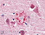 Ubiquitin polyclonal antibody Immunohistochemistry