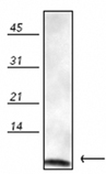 Ubiquitin polyclonal antibody Western blot