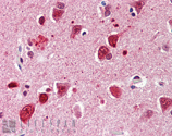 Ubiquitin monoclonal antibody (P4G7-H11) Immunohistochemistry