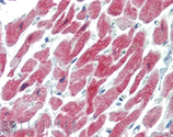 αB-Crystallin monoclonal antibody (1B6.1-3G4) Immunohistochemistry