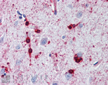 αB-Crystallin polyclonal antibody Immunohistochemistry