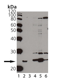 [pSer59]αB-Crystallin polyclonal antibody Western blot