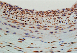 HSP47 monoclonal antibody (M16.10A1) Immunohistochemistry