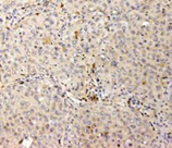 HSP47 monoclonal antibody (M16.10A1) Immunohistochemistry