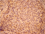 [pSer15]HSP27 polyclonal antibody Immunohistochemistry