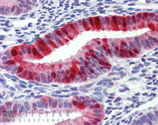 Metallothionein monoclonal antibody (UC1MT) Immunohistochemistry