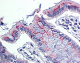 ERp57 polyclonal antibody Immunohistochemistry