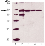 Calreticulin polyclonal antibody Western blot