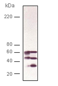 Calcineurin A polyclonal antibody Western blot