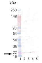 p23 polyclonal antibody Western blot