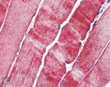 HSP27 monoclonal antibody (G3.1) Immunohistochemistry