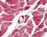 HSP27 polyclonal antibody Immunohistochemistry