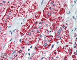 HSP60 monoclonal antibody (LK-1) Immunohistochemistry