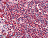 HSC70/HSP73 monoclonal antibody (1B5) Immunohistochemistry