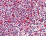 HSC70/HSP70 monoclonal antibody (N27F3-4) Immunohistochemistry