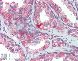 HSP90 polyclonal antibody Immunohistochemistry