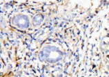 HSP90β monoclonal antibody (K3705) Immunohistochemistry