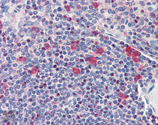 HSP90 polyclonal antibody Immunohistochemistry