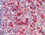 Grp94 monoclonal antibody (9G10) Immunohistochemistry