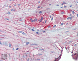 Grp94 polyclonal antibody Immunohistochemistry
