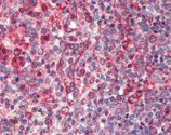 Calnexin polyclonal antibody Immunohistochemistry