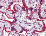 Calnexin polyclonal antibody Immunohistochemistry