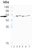 HSP65 (mycobacterial) monoclonal antibody (3F7) Western blot