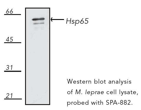 HSP65 (mycobacterial) monoclonal antibody (4H11) Western blot