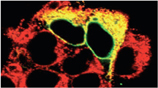 PDI monoclonal antibody (1D3) Immunohistochemistry