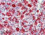 HO-1 polyclonal antibody Immunohistochemistry