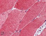 HSF1 monoclonal antibody (10H8) Immunohistochemistry