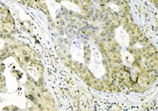 Grp75/Mortalin monoclonal antibody (30A5) Immunohistochemistry