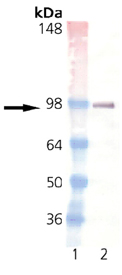 Estrogen receptor monoclonal antibody (h-151) Western blot