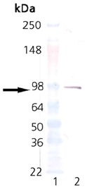 Estrogen receptor alpha monoclonal antibody (C-542) Western blot