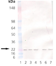 KDEL receptor monoclonal antibody (KR-10) Western blot