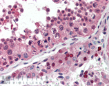 NSF monoclonal antibody (9G7-3) Immunohistochemistry