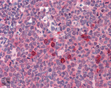 rSec6 monoclonal antibody (9H5) Immunohistochemistry