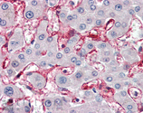 Membrin polyclonal antibody Immunohistochemistry