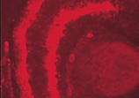 CSP polyclonal antibody Immunohistochemistry