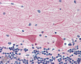 Syntaxin 2 polyclonal antibody Immunohistochemistry