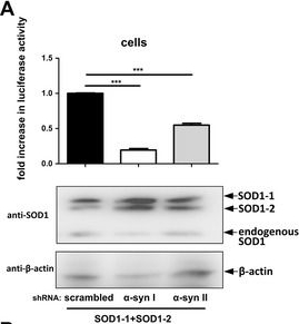 ADI-SOD-100 Cu/Zn SOD polyclonal antibody Western Blot Mouse 5