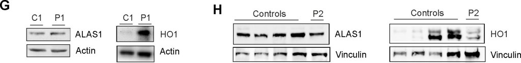 ADI-SPA-896 HO-1 polyclonal antibody Western Blot Human 1