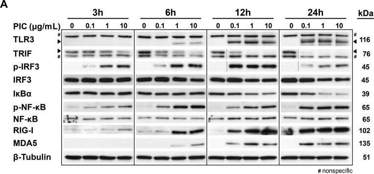 ALX-215-016 TRIF polyclonal antibody Western Blot Human 1