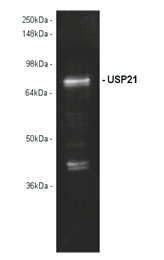 Lane 3: Rat Brain Tissue Extract (Prod. No. ADI-LYT-RB100)."
