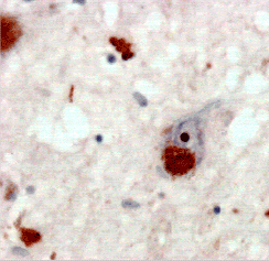 Polyubiquitin (K63-linkage-specific) monoclonal antibody (HWA4C4) Immunohistochemistry