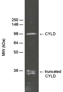 CYLD (human) polyclonal antibody Western blot