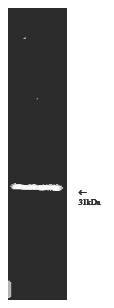 Proteasome activator 11S γ subunit polyclonal antibody Western blot